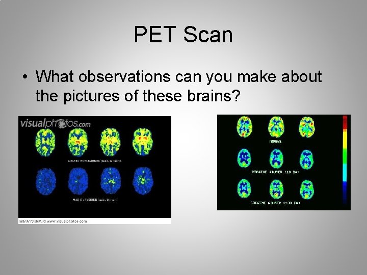 PET Scan • What observations can you make about the pictures of these brains?
