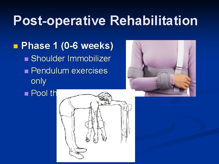 Post-operative Rehabilitation n Phase 1 (0 -6 weeks) Shoulder Immobilizer n Pendulum exercises only