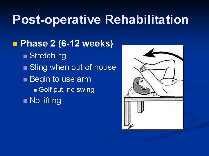 Post-operative Rehabilitation n Phase 2 (6 -12 weeks) Stretching n Sling when out of