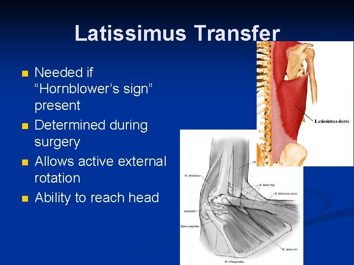 Latissimus Transfer n n Needed if “Hornblower’s sign” present Determined during surgery Allows active