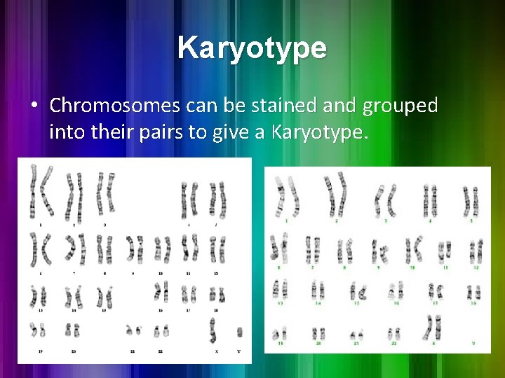 Karyotype • Chromosomes can be stained and grouped into their pairs to give a Karyotype • Chromosomes can be stained and grouped into their pairs to give a