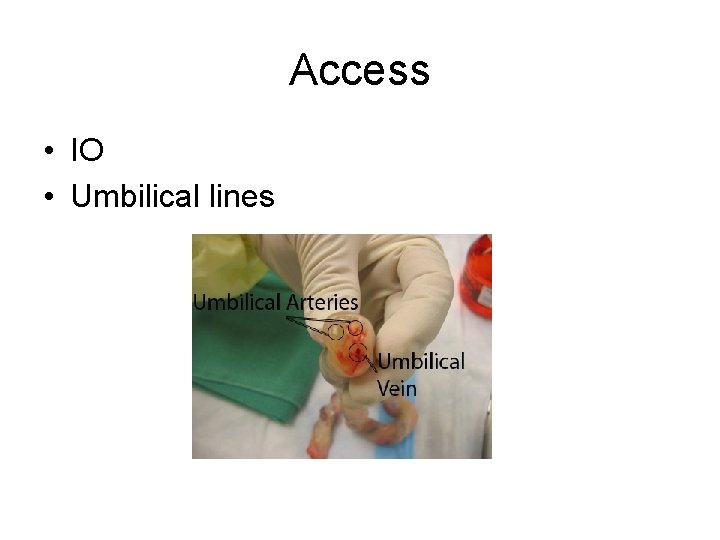 Access • IO • Umbilical lines 