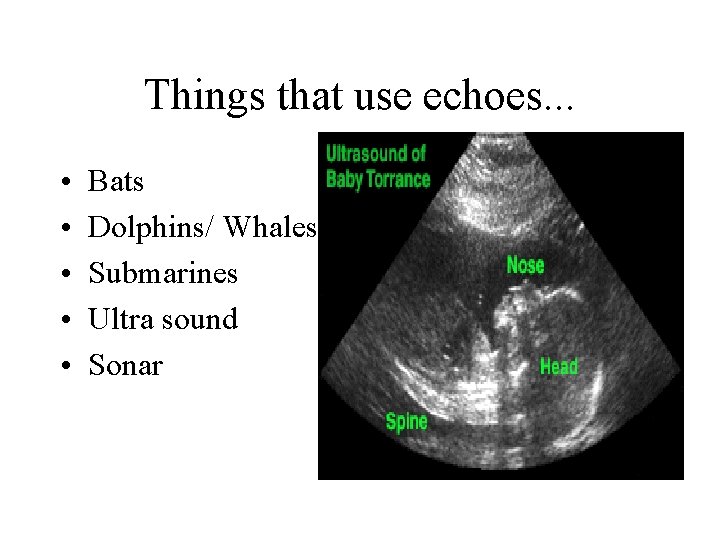 Things that use echoes. . . • • • Bats Dolphins/ Whales Submarines Ultra Things that use echoes. . . • • • Bats Dolphins/ Whales Submarines Ultra