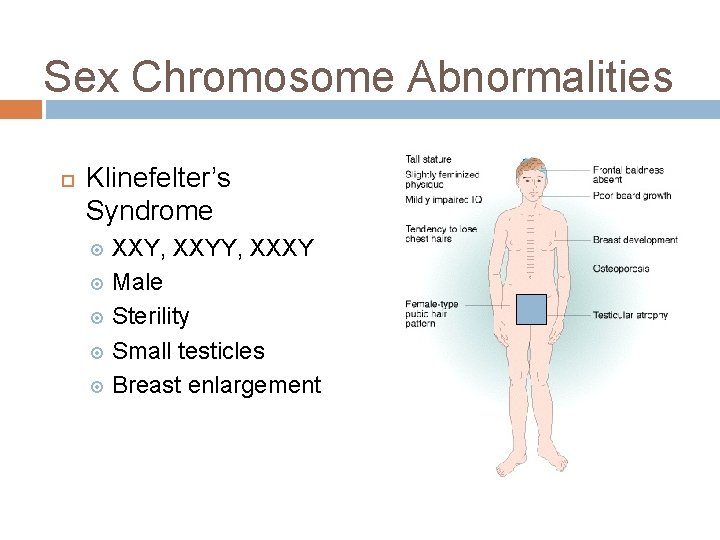 Sex Chromosome Abnormalities Klinefelter’s Syndrome XXY, XXYY, XXXY Male Sterility Small testicles Breast enlargement