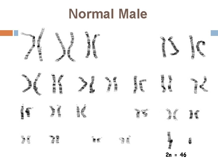 Normal Male 2 n = 46 34 