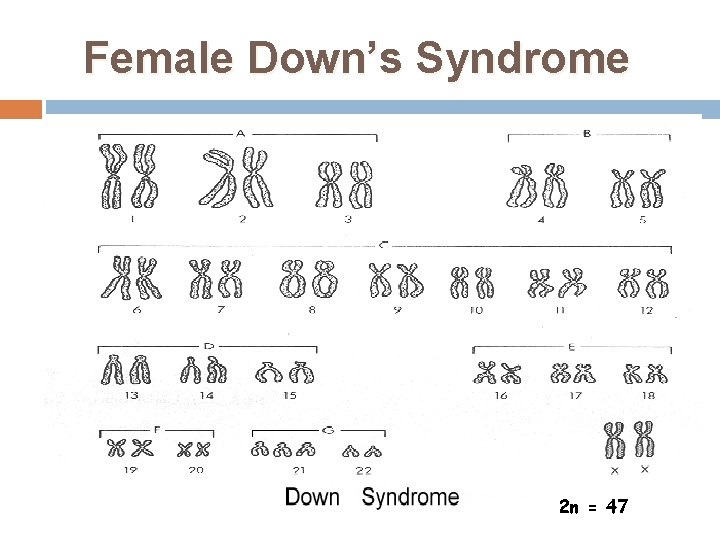 Female Down’s Syndrome 2 n = 47 37 
