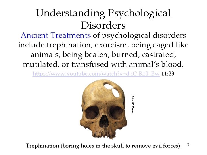 Understanding Psychological Disorders Ancient Treatments of psychological disorders include trephination, exorcism, being caged like
