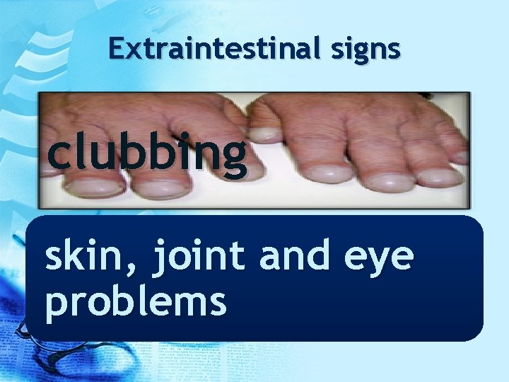 Extraintestinal signs clubbing skin, joint and eye problems 