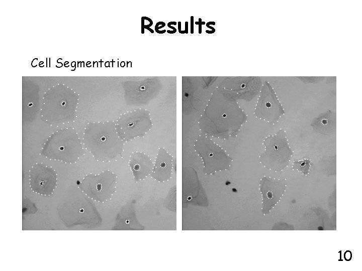 Results Cell Segmentation 10 