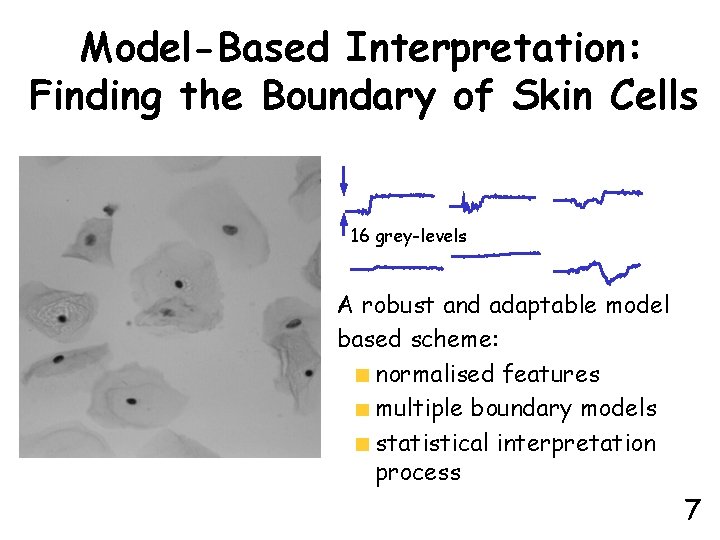 Model-Based Interpretation: Finding the Boundary of Skin Cells 16 grey-levels A robust and adaptable