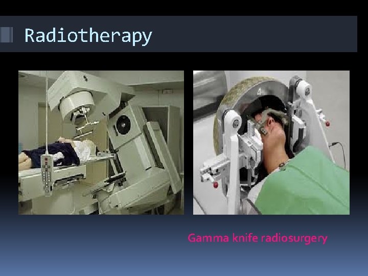 Radiotherapy Linear accelerator Gamma knife radiosurgery 