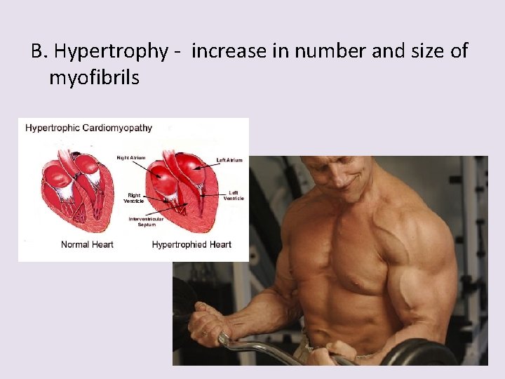 B. Hypertrophy - increase in number and size of myofibrils 