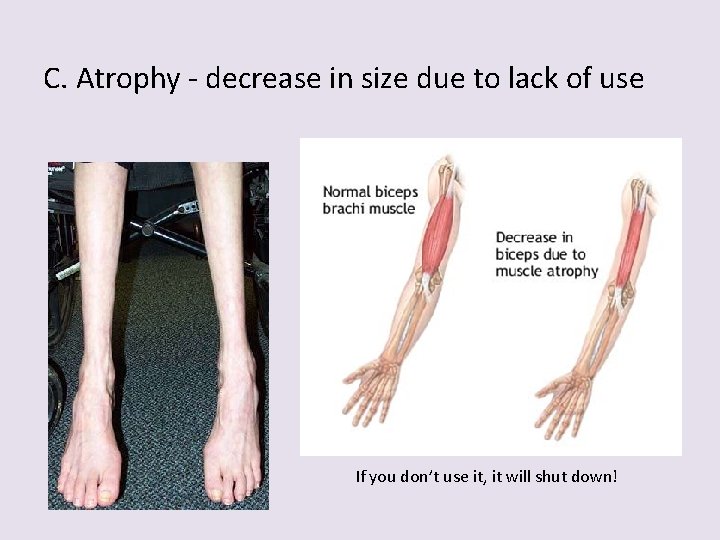 C. Atrophy - decrease in size due to lack of use If you don’t