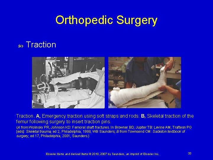 Orthopedic Surgery Traction. A, Emergency traction using soft straps and rods. B, Skeletal traction