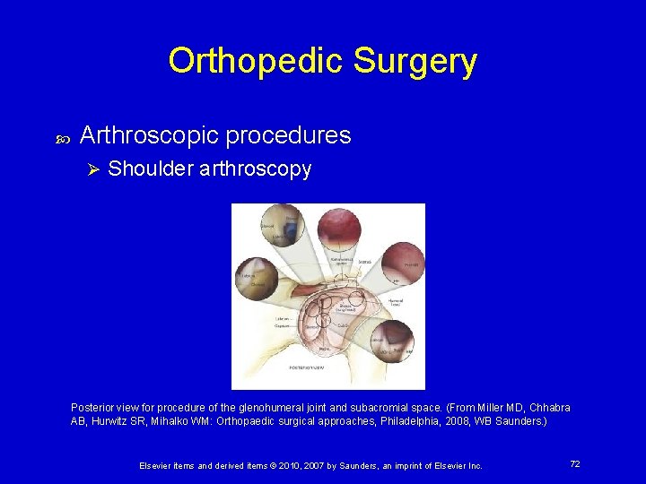 Orthopedic Surgery Arthroscopic procedures Ø Shoulder arthroscopy Posterior view for procedure of the glenohumeral