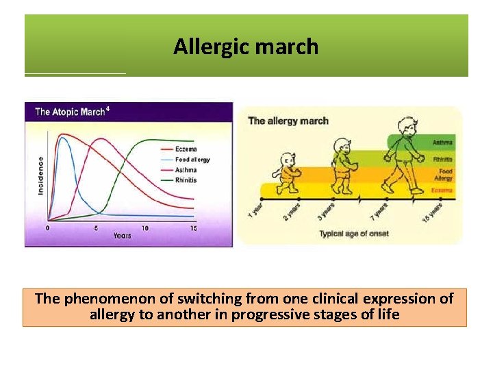 Allergic march The phenomenon of switching from one clinical expression of allergy to another
