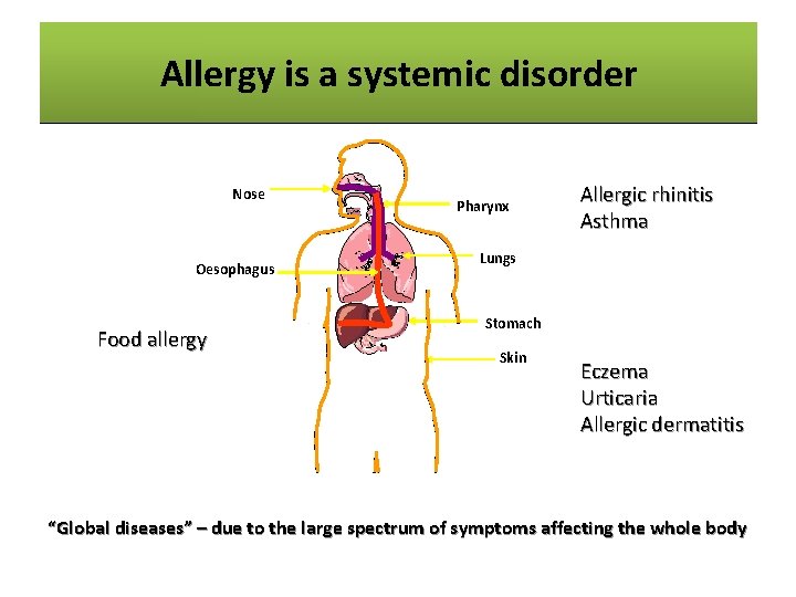 Allergyisisaasystemic disorder Allergy disorder Nose Oesophagus Food allergy Pharynx Allergic rhinitis Asthma Lungs Stomach
