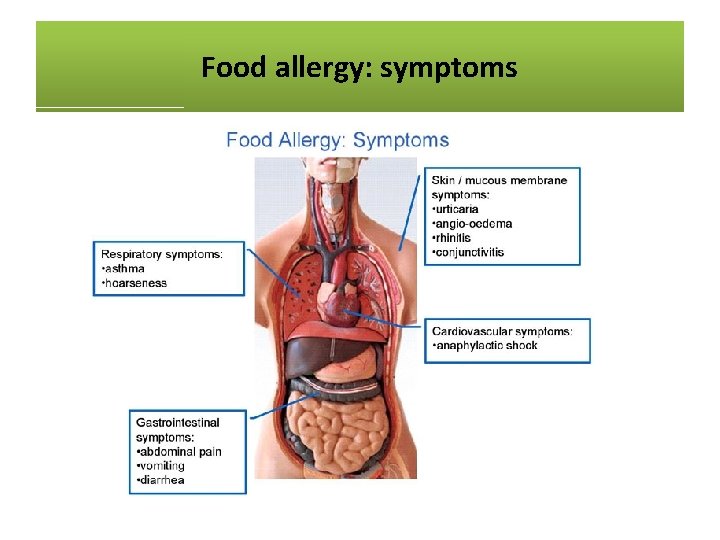 Food allergy: symptoms 