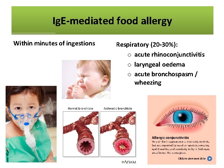 Ig. E-mediated food allergy Within minutes of ingestions • Anaplyhlaxis o skin and mucosa