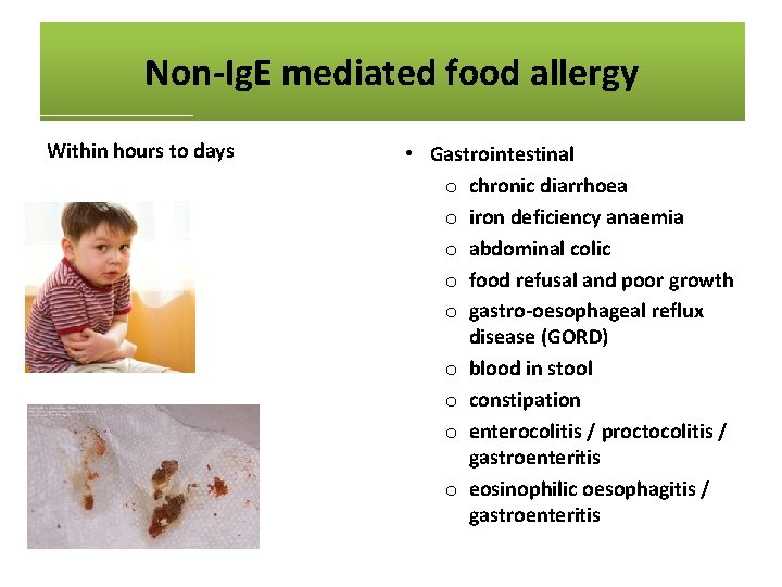 Non-Ig. E mediated food allergy Within hours to days • Skin o atopic dermatitis