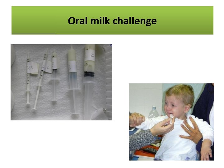 Oral milk challenge 