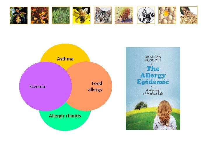Asthma Food allergy Eczema Allergic rhinitis 