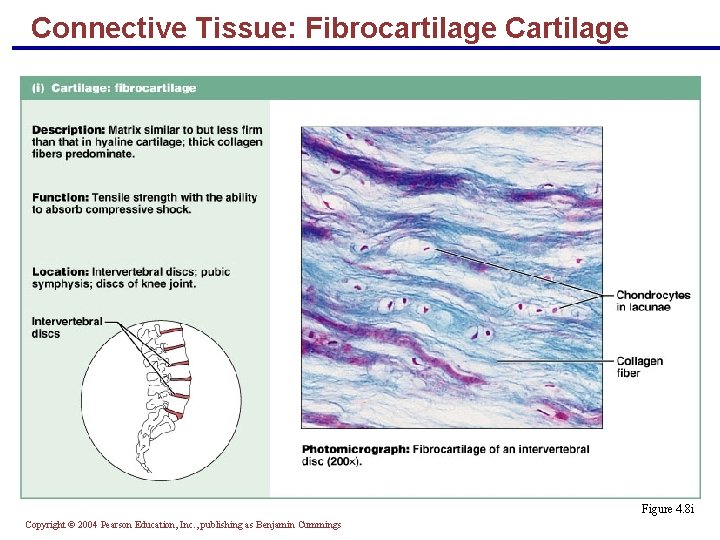 Connective Tissue: Fibrocartilage Cartilage § Matrix similar to hyaline cartilage but less firm with