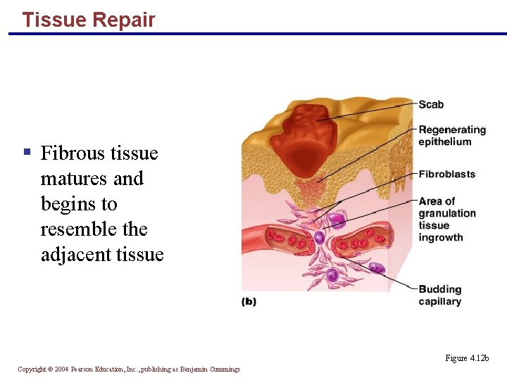 Tissue Repair § Fibrous tissue matures and begins to resemble the adjacent tissue Figure Tissue Repair § Fibrous tissue matures and begins to resemble the adjacent tissue Figure