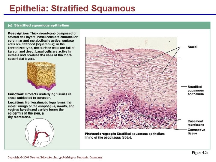 Epithelia: Stratified Squamous § Thick membrane composed of several layers of cells § Function