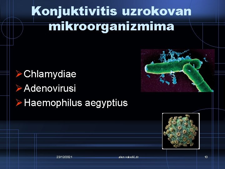 Konjuktivitis uzrokovan mikroorganizmima Ø Chlamydiae Ø Adenovirusi Ø Haemophilus aegyptius 23/12/2021 alen vukelić, dr