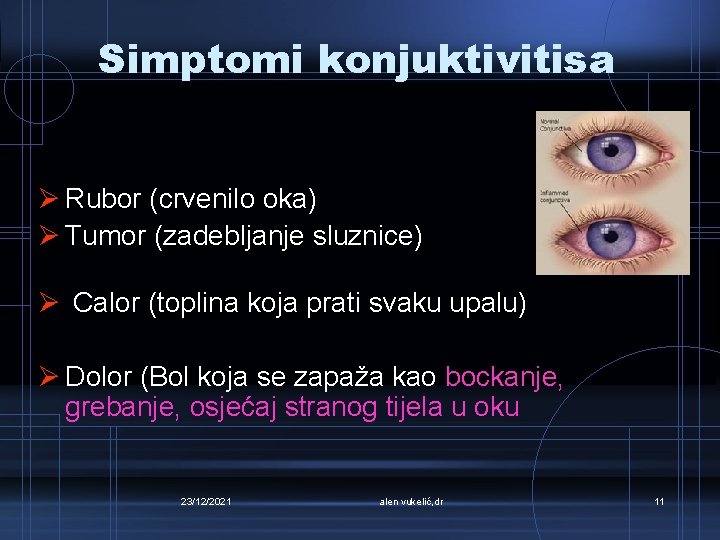 Simptomi konjuktivitisa Ø Rubor (crvenilo oka) Ø Tumor (zadebljanje sluznice) Ø Calor (toplina koja