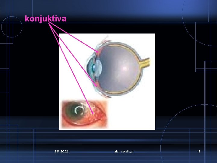 konjuktiva 23/12/2021 alen vukelić, dr 13 