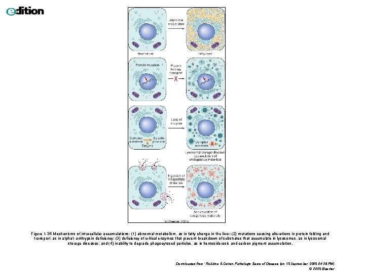 Figure 1 -35 Mechanisms of intracellular accumulations: (1) abnormal metabolism, as in fatty change