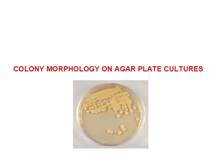 COLONY MORPHOLOGY ON AGAR PLATE CULTURES 
