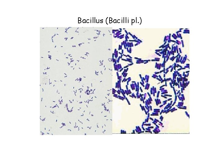 Bacillus (Bacilli pl. ) 