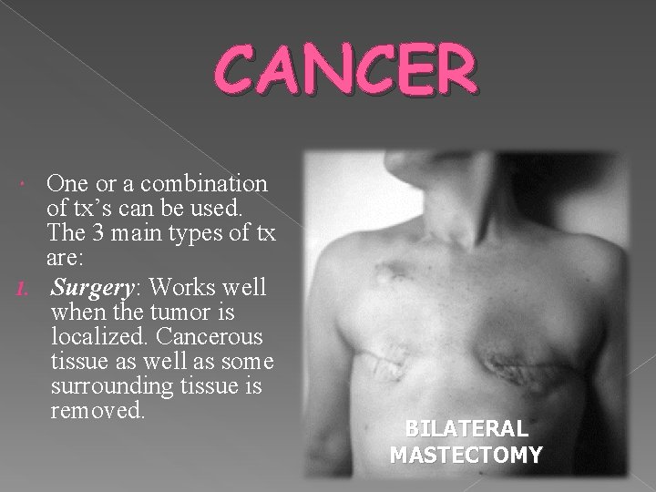 CANCER One or a combination of tx’s can be used. The 3 main types