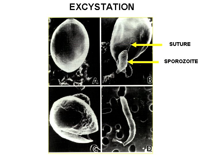 EXCYSTATION SUTURE SPOROZOITE 