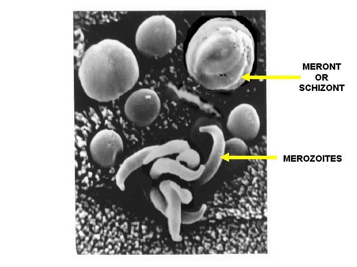 MERONT OR SCHIZONT MEROZOITES 