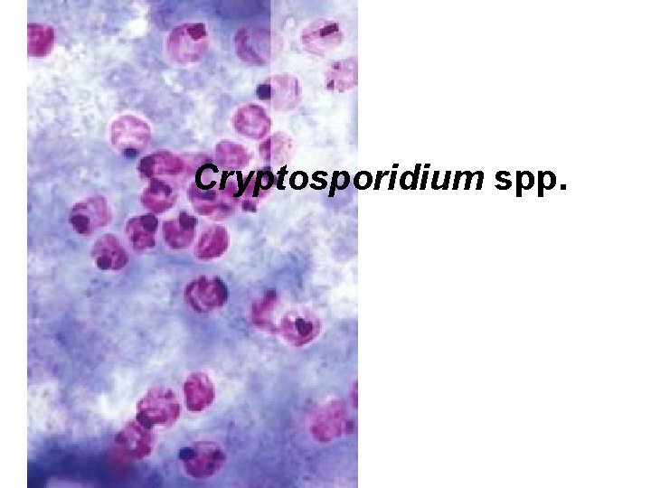 Cryptosporidium spp. 