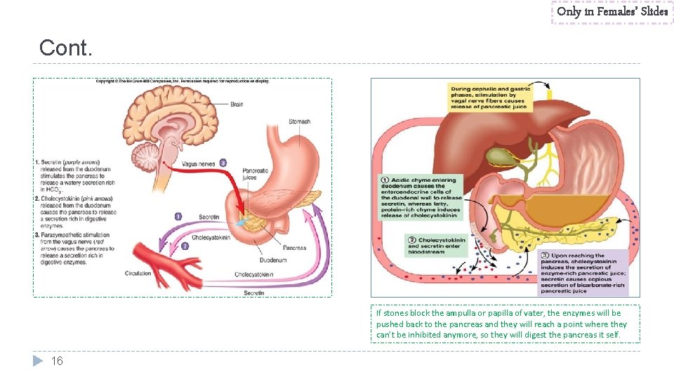 Only in Females’ Slides Cont. If stones block the ampulla or papilla of vater,