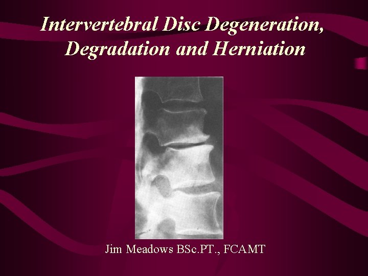 Intervertebral Disc Degeneration, Degradation and Herniation Jim Meadows BSc. PT. , FCAMT 