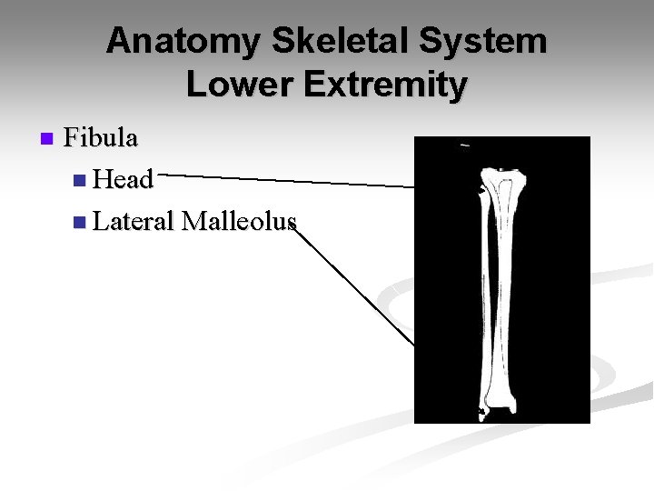 Anatomy Skeletal System Lower Extremity n Fibula n Head n Lateral Malleolus 
