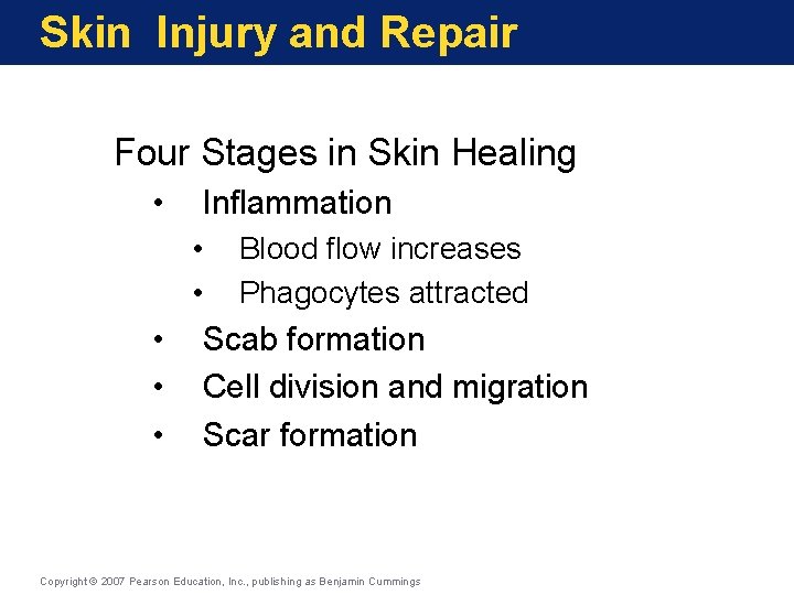 Skin Injury and Repair Four Stages in Skin Healing • Inflammation • • •