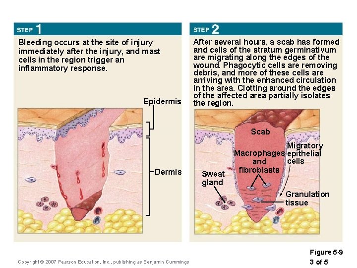 Bleeding occurs at the site of injury immediately after the injury, and mast cells