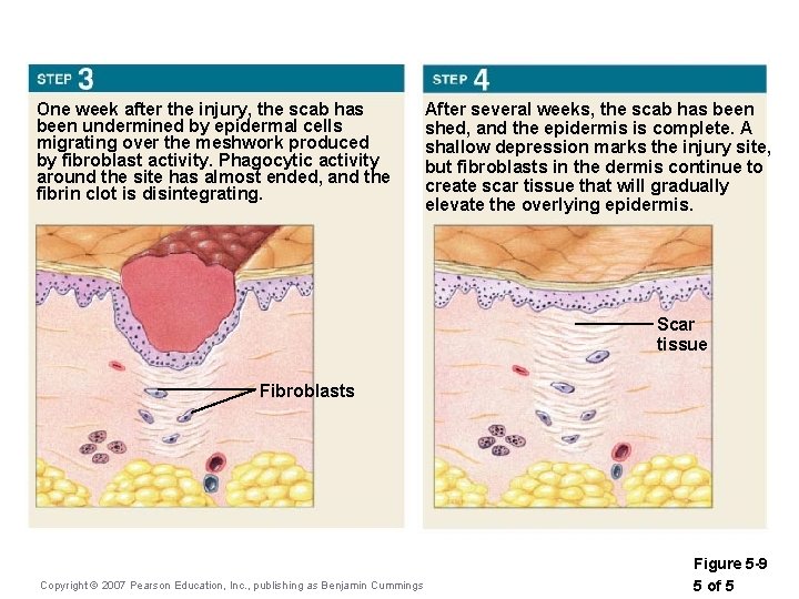 One week after the injury, the scab has been undermined by epidermal cells migrating