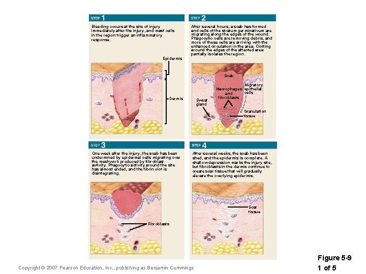 Bleeding occurs at the site of injury immediately after the injury, and mast cells