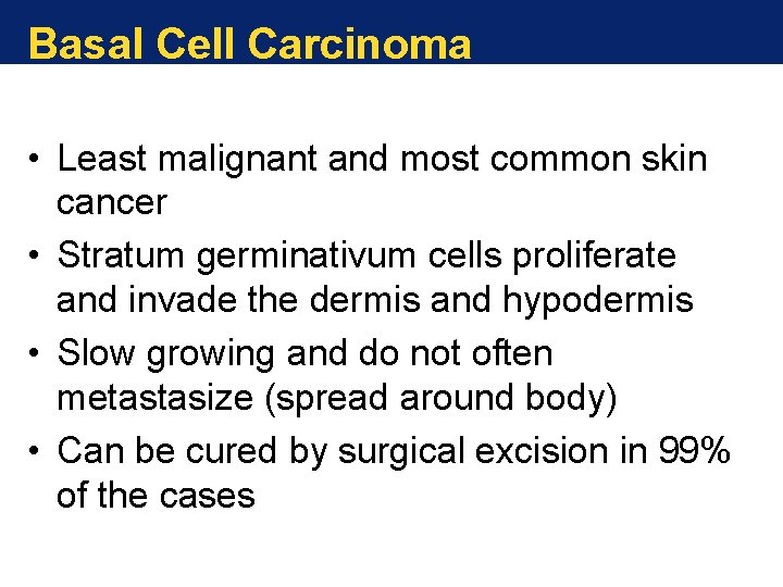 Basal Cell Carcinoma • Least malignant and most common skin cancer • Stratum germinativum