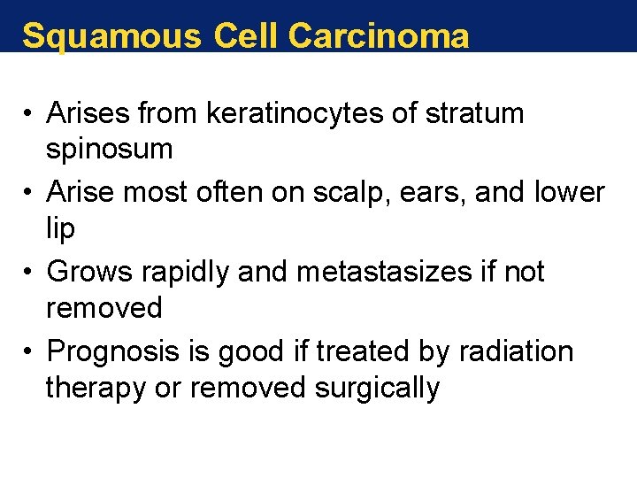 Squamous Cell Carcinoma • Arises from keratinocytes of stratum spinosum • Arise most often