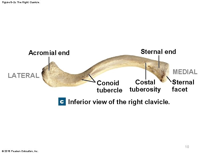 Figure 8– 2 c The Right Clavicle. Sternal end Acromial end MEDIAL LATERAL Conoid