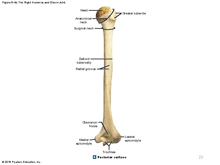 Figure 8– 4 b The Right Humerus and Elbow Joint. Head Greater tubercle Anatomical